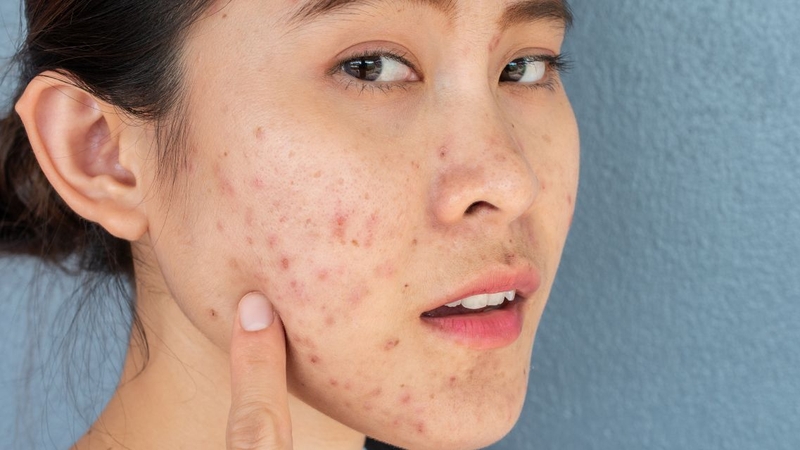 Đáp ứng đúng nhu cầu của da ở từng thời điểm sẽ giúp da khỏe, đẹp