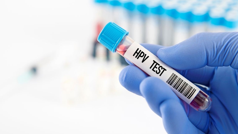 Xét nghiệm HPV giúp phát hiện sự hiện diện của virus trong mẫu bệnh phẩm