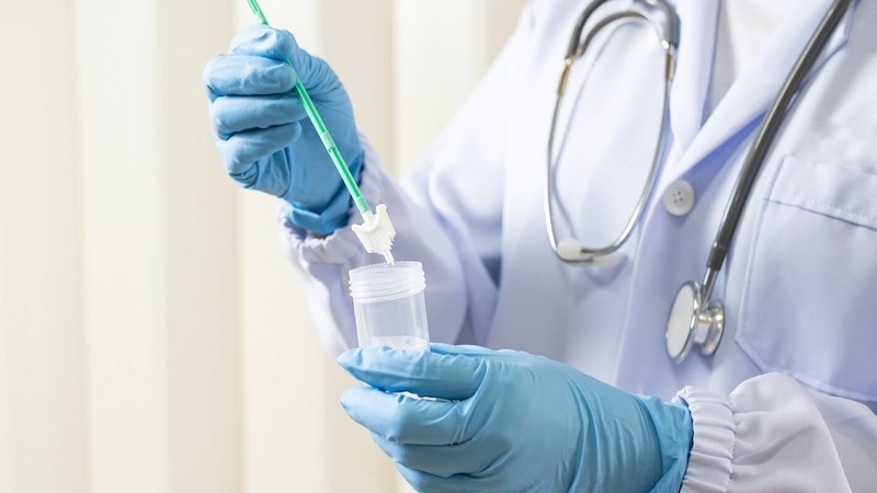 HPV Cobas là gì? Có cần tầm soát ung thư cổ tử cung không? 3