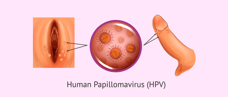 HPV là virus nguy hiểm lây lan bệnh nguy hiểm qua đường tình dục