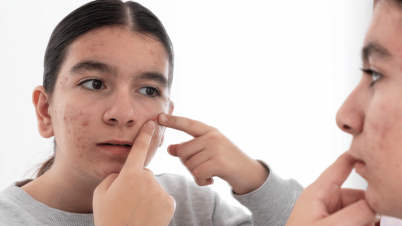 13 tuổi có nên dùng kem dưỡng da body không? 4