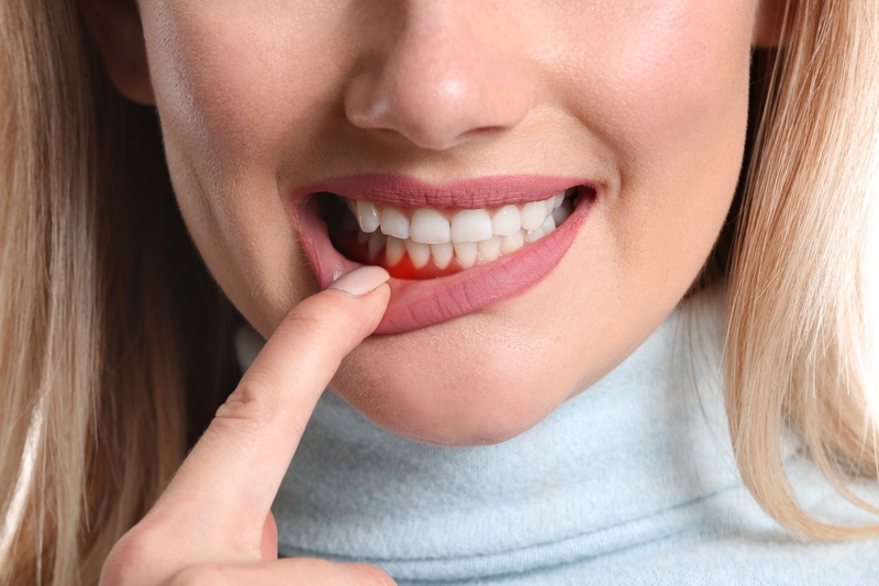 Một số bệnh về răng miệng phổ biến mà bạn cần phải chú ý 2