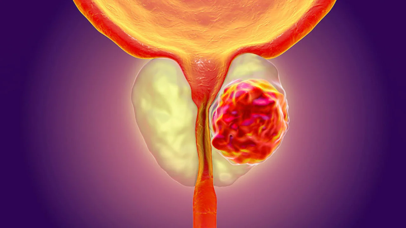 Abiraterone: Chỉ định, cách dùng và lưu ý khi sử dụng 1.png