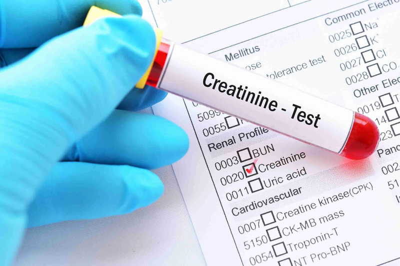 25 chỉ số xét nghiệm sinh hóa phổ biến dùng trong xét nghiệm chẩn đoán 2