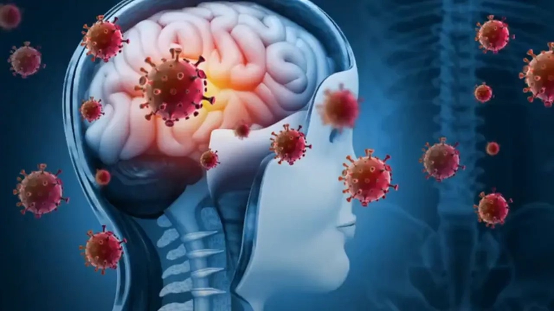 Bệnh viêm màng não có nguy hiểm không? 3