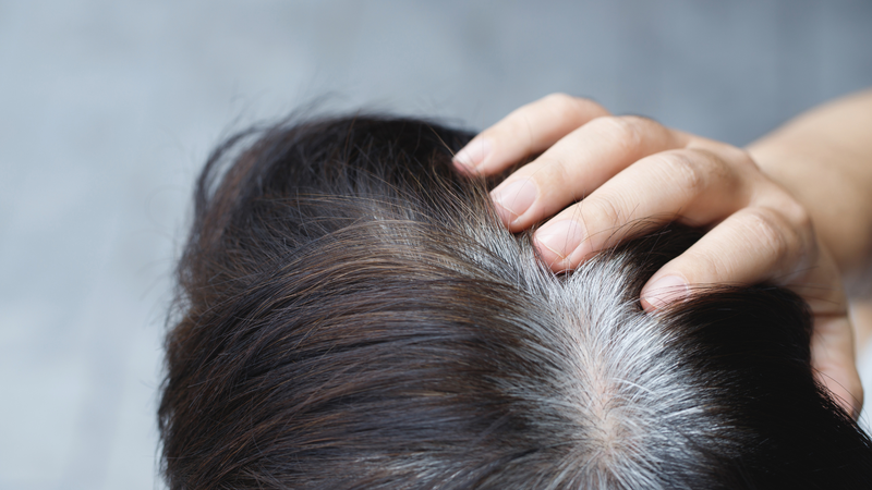 4 cách ngăn ngừa tóc bạc sớm khi còn trẻ áp dụng càng sớm càng tốt 1