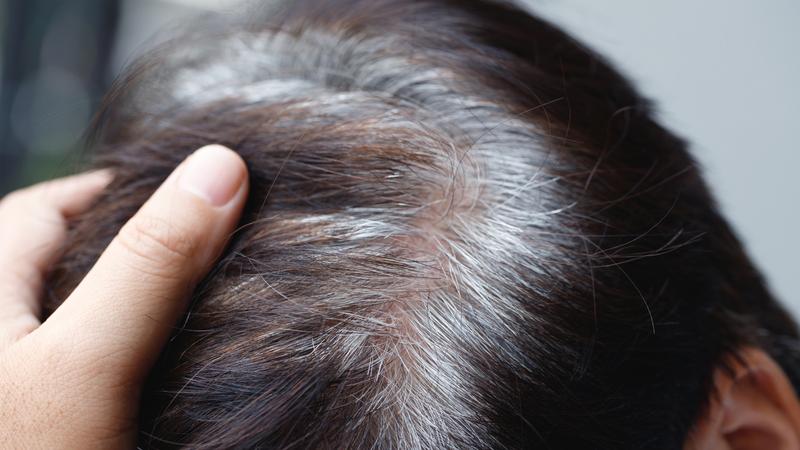 4 cách ngăn ngừa tóc bạc sớm khi còn trẻ áp dụng càng sớm càng tốt 2