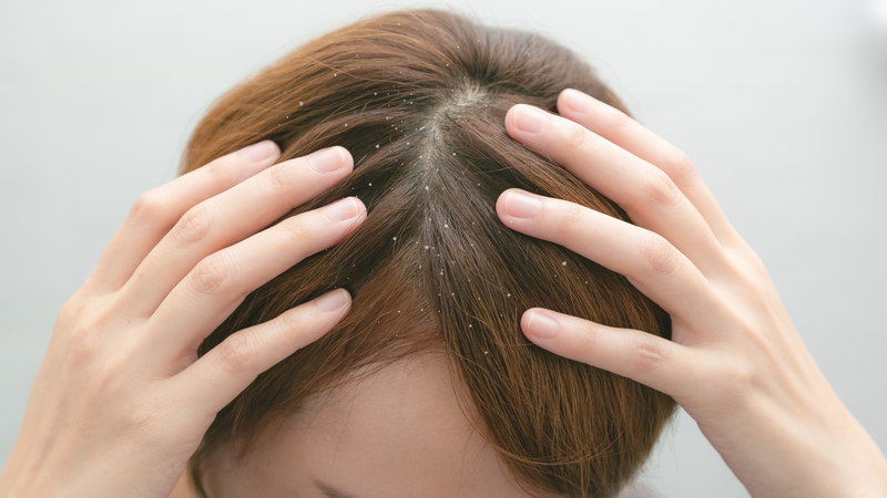4 dấu hiệu cho thấy bạn đang gội đầu sai cách 1