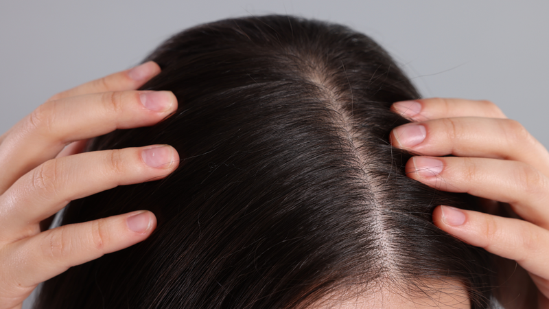 Làm sạch nhẹ nhàng giúp da đầu thông thoáng và kích thích nang tóc