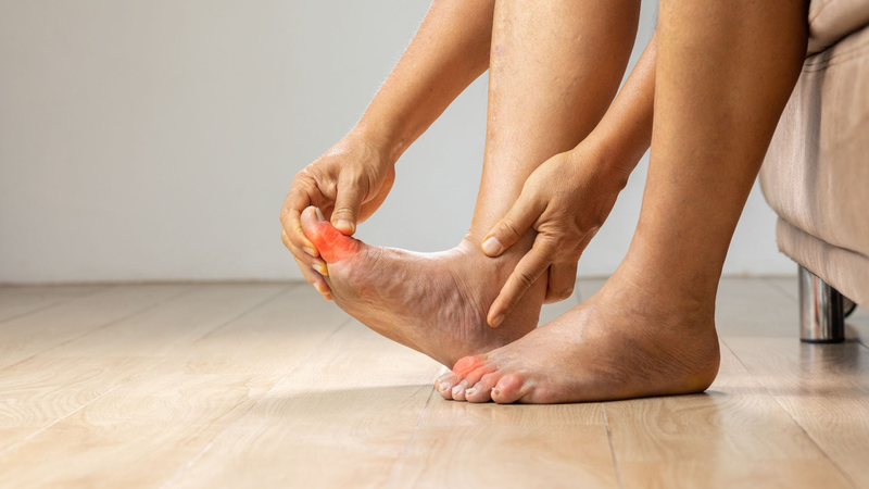5 kiểu người dễ bị tình trạng axit uric cao, mắc bệnh gút 3