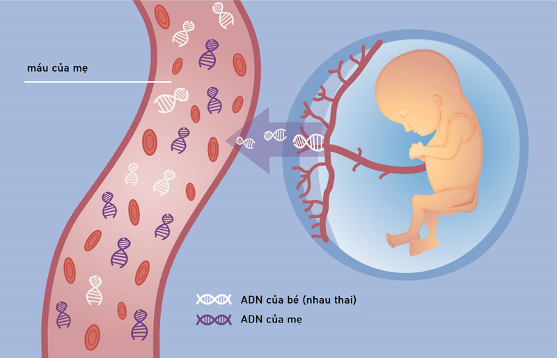 9 tuần làm xét nghiệm NIPT: Lựa chọn sáng suốt hay quyết định vội vàng 1