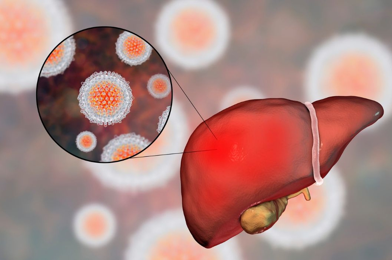 Xét nghiệm Anti HCV nonreactive trong chẩn đoán viêm gan C 1