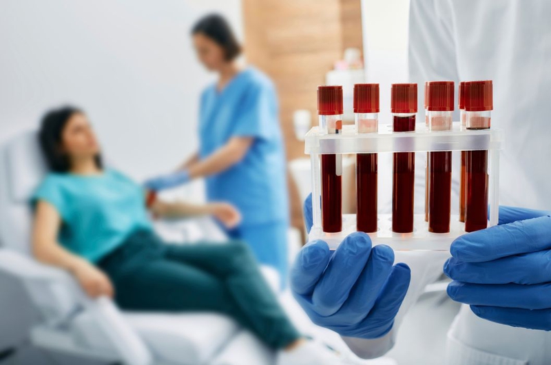Xét nghiệm Anti HCV nonreactive trong chẩn đoán viêm gan C 3