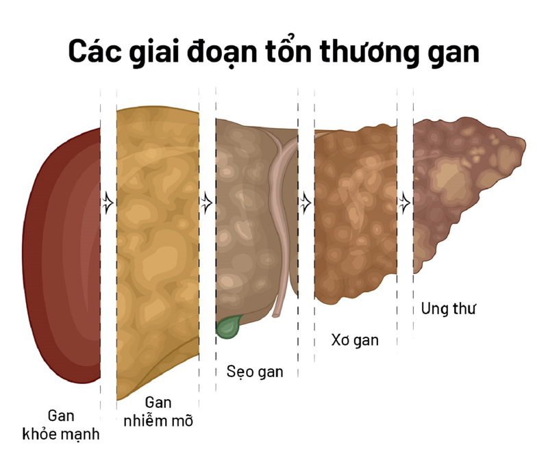 nhan-biet-som-cac-dau-hieu-gan-nhiem-mo 3