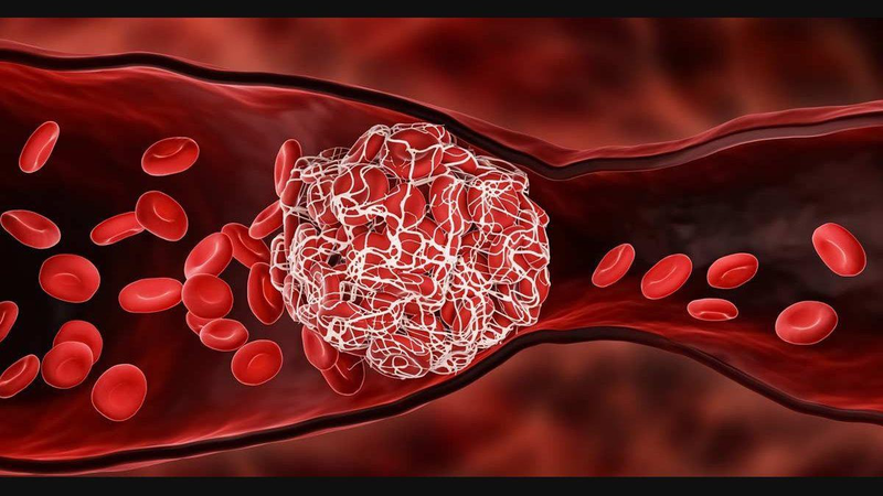 Erythropoietin là gì? Những điều người bệnh cần hiểu rõ trước khi dùng thuốc 7.jpg