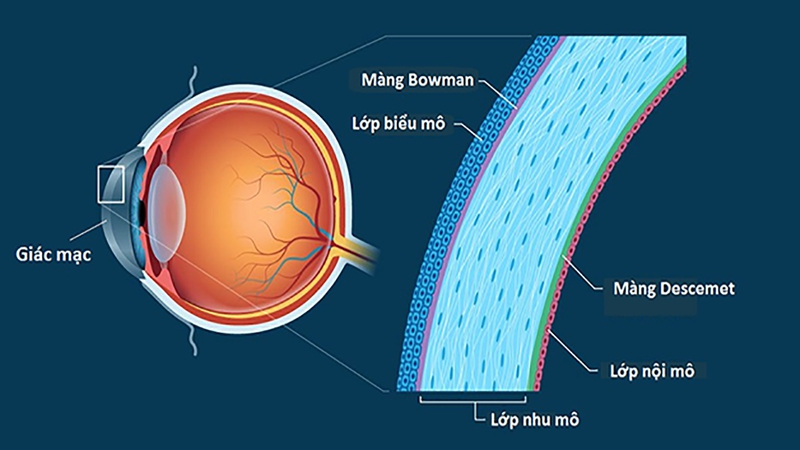 Giác mạc 03