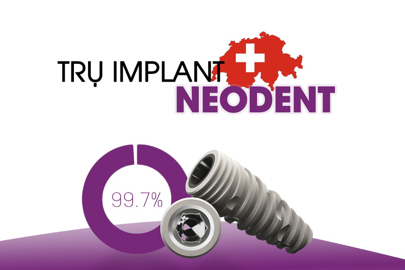 Tìm hiểu về đặc điểm và lợi ích khi cấy Implant Neodent 1