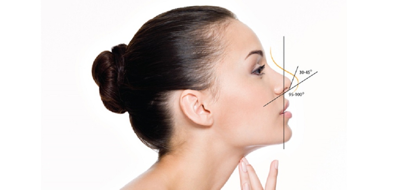 Mũi hếch là gì Cách khắc phục mũi hếch an toàn và hiệu quả 1.jpg