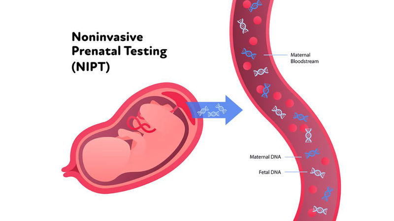 NIPT 9.5 giúp phát hiện 9 bất thường nhiễm sắc thể phổ biến