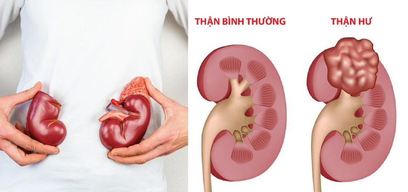 Sinh lý thận 04