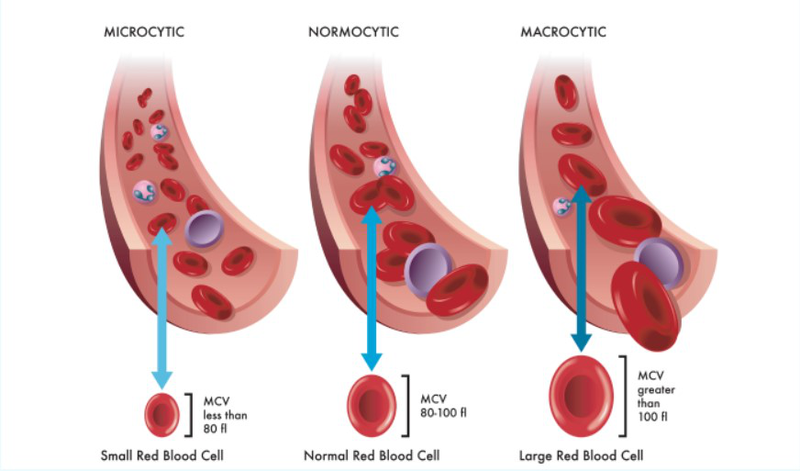 Thể tích trung bình hồng cầu: Ý nghĩa và ứng dụng trong xét nghiệm máu