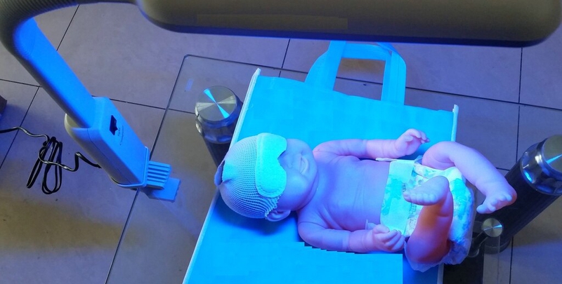 Trẻ sơ sinh 1 tháng tuổi chưa hết vàng da: Nguyên nhân và cách chăm sóc 3