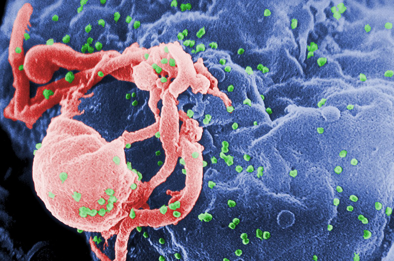 Triệu chứng HIV sau 4 năm như thế nào? Điều trị ra sao? 1