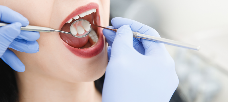 Ung thư nướu răng là gì? Những điều cần biết về Ung thư nướu răng 7