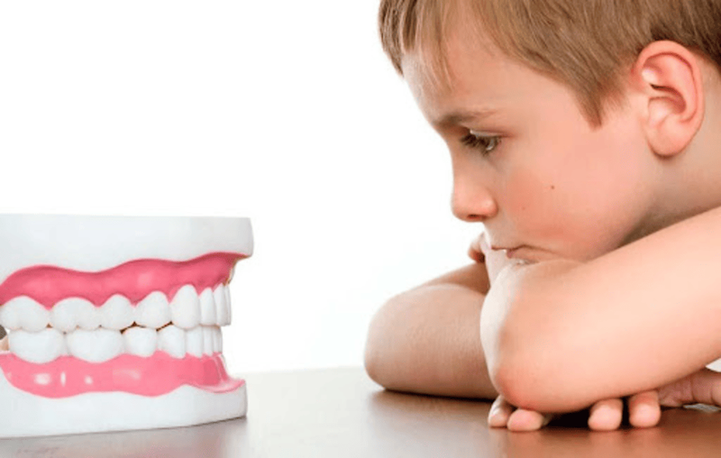 Viêm lợi khi niềng răng và cách điều trị 2.png