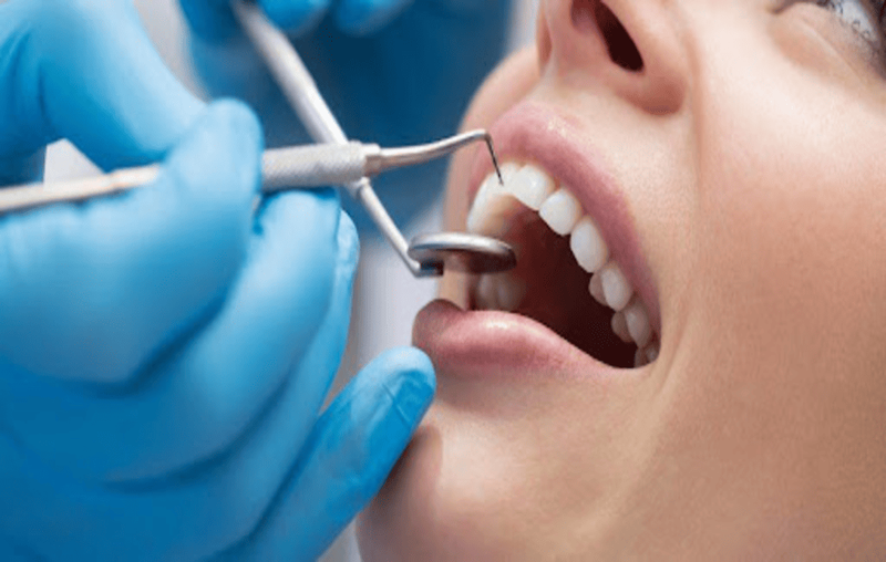 Viêm lợi khi niềng răng và cách điều trị 3.png