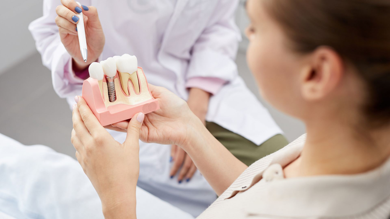 Abutment cá nhân hóa là gì? Chi phí và đối tượng nên cân nhắc sử dụng 3
