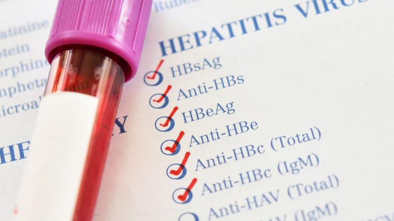 Anti-HBc IgM: Xét Nghiệm Quan Trọng Trong Chẩn Đoán Viêm Gan B Cấp Tính 2
