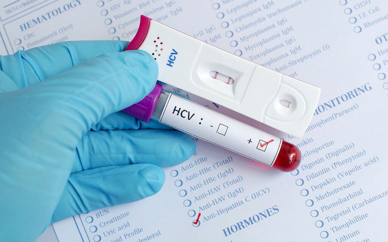 Anti HCV-nonreactive là gì? Biện pháp phòng ngừa bệnh viêm gan C 2