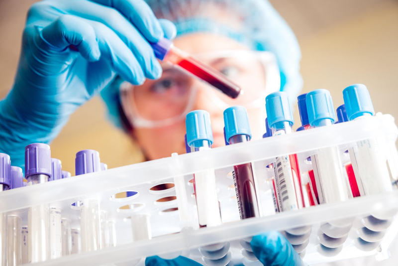 Aplastic anemia là gì? Những biến chứng thường gặp 4
