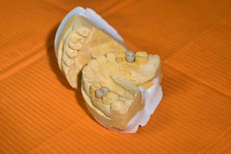 Cách giảm đau sau khi cấy Implant ai cũng nên biết 2