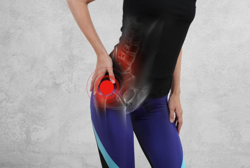 Đau khớp háng ở phụ nữ: Nguyên nhân, triệu chứng, cách điều trị và phòng ngừa hiệu quả 3
