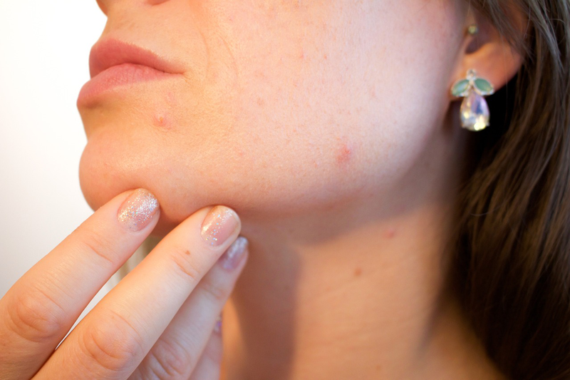 Facial cupping là gì? Lợi ích của facial cupping đối với làn da 4