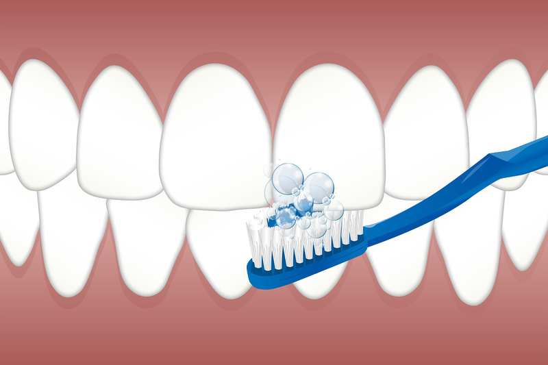 Hàn răng thẩm mỹ là gì? Những lưu ý trước và sau khi thực hiện 5