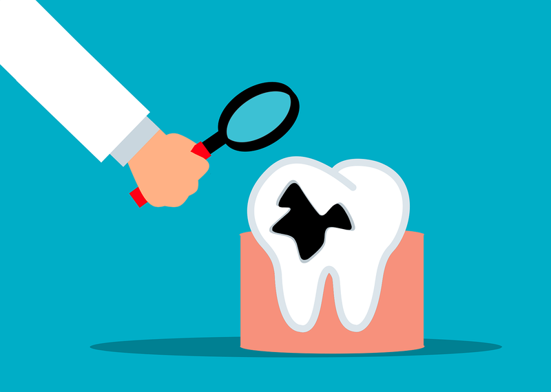 Hoại tử tủy răng có nguy hiểm không? Điều trị và phòng ngừa ra sao? 1