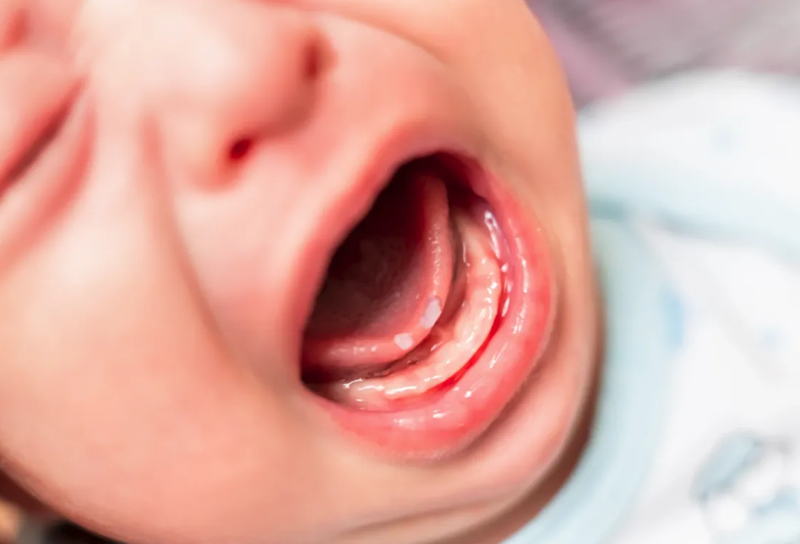 Mách mẹ các cách trị nhiệt miệng ở trẻ sơ sinh hiệu quả 1