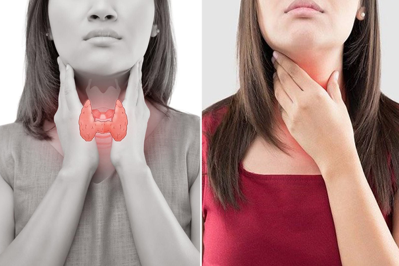Nhân thùy phải tuyến giáp TIRADS 3 là bệnh gì? Các phương pháp điều trị hiệu quả 1 