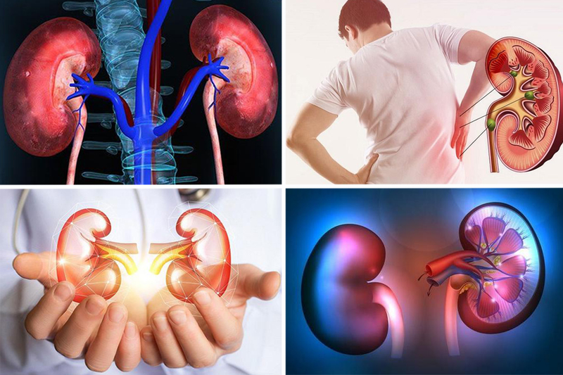 Suy thận cấp có phải chạy thận không? Các biến chứng và đối tượng nguy cơ gặp suy thận cấp 1