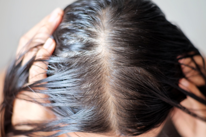 Tóc bết là gì? Cách chăm sóc và trị dứt điểm tóc bết thế nào? 1