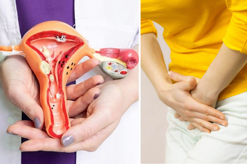 Viêm phụ khoa có tắm biển được không​? Hướng dẫn cách hỗ trợ điều trị và phòng ngừa viêm phụ khoa hiệu quả 1