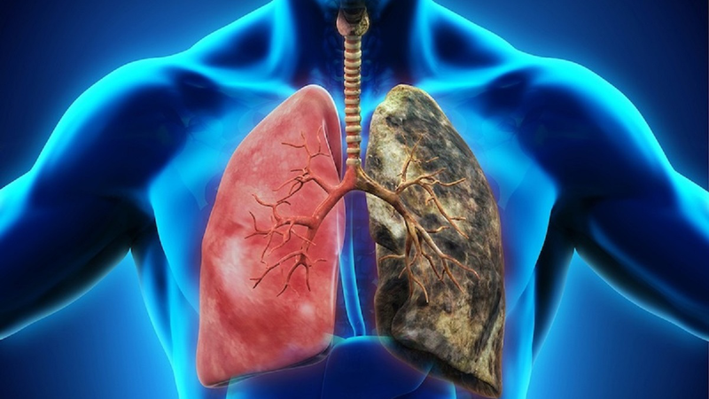 Bạn có biết phổi người nặng bao nhiêu 4