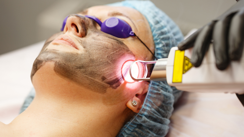 Bắn laser bị nổi mụn nước: Tìm hiểu nguyên nhân và cách khắc phục để bảo vệ làn da 3