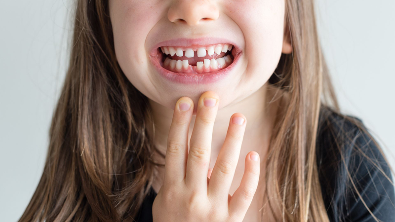  Bao nhiêu tuổi thì hết thay răng? Những điều cần lưu ý để răng vĩnh viễn mọc đều đẹp4