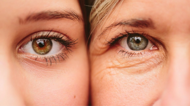 Nếp nhăn dưới mắt: Bật mí các phương pháp cải thiện hiệu quả 1