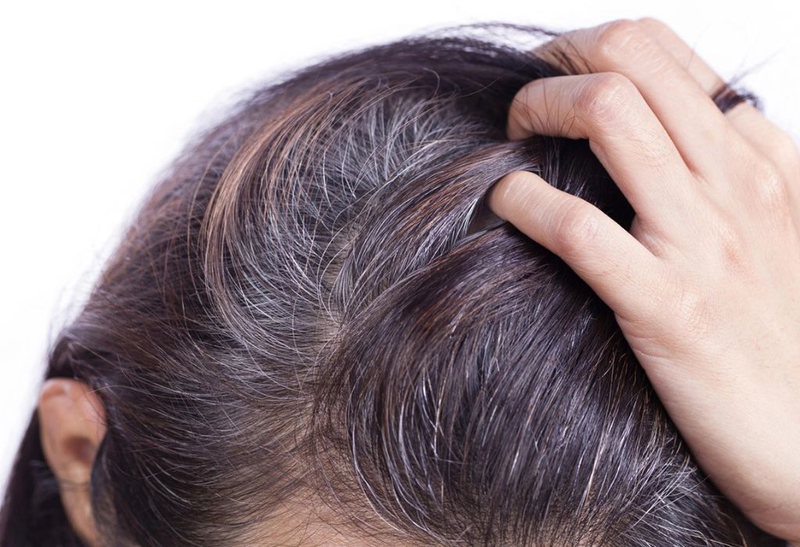 Bật mí những cách phòng ngừa tóc bạc sớm hiệu quả 1