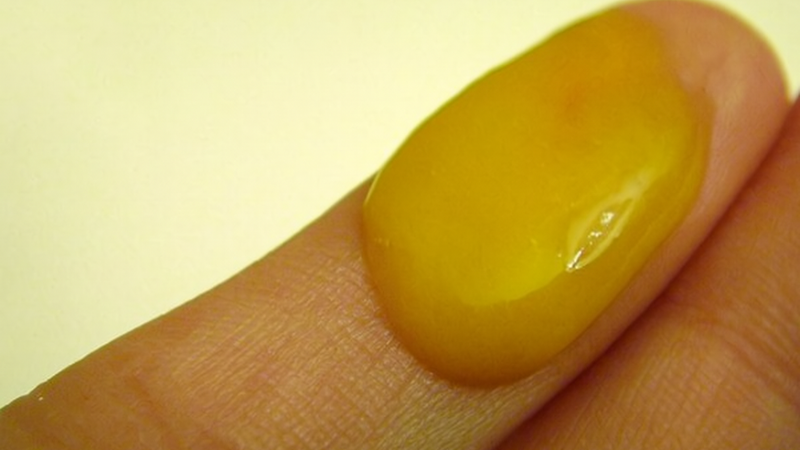 Bé gái 5 tuổi ra khí hư màu vàng có đáng lo? Cha mẹ cần làm gì? 1